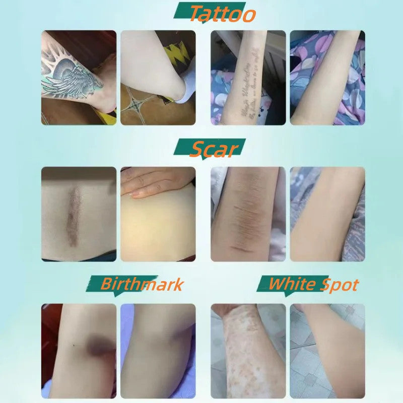 Tattoo & Scar Cover-Up Patches ( 6PC )