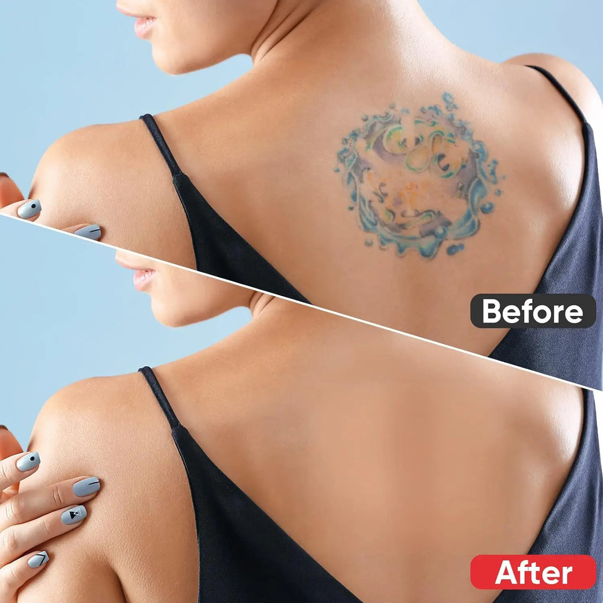 Tattoo & Scar Cover-Up Patches ( 6PC )