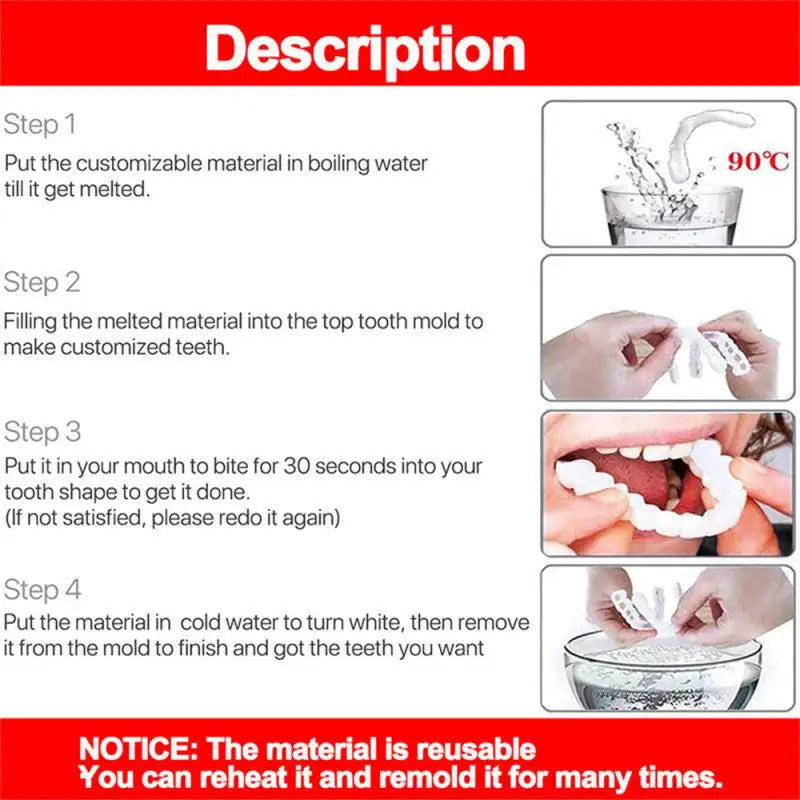 Snap-On Tooth Veneers for Confidence