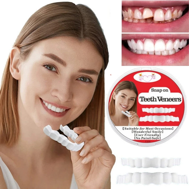 Snap-On Tooth Veneers for Confidence