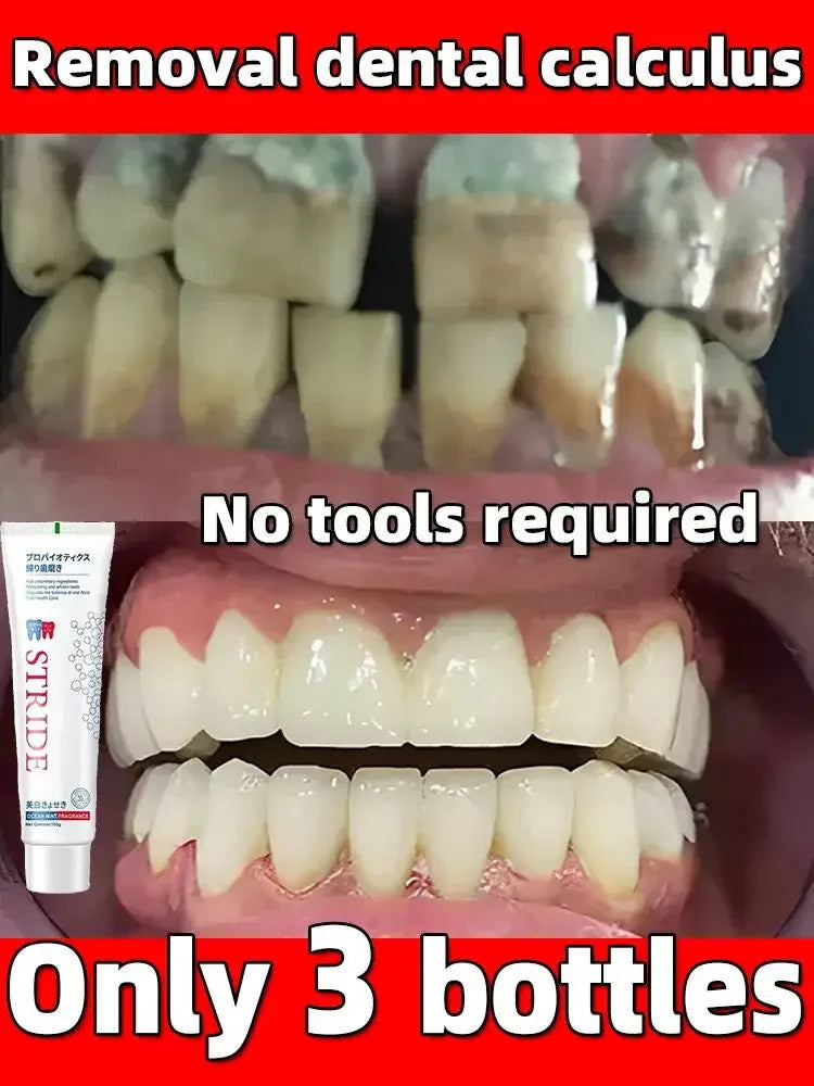 Dental Calculus Remover Whitening Toothpaste