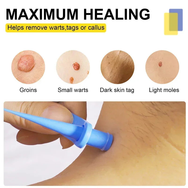 1 Set Skin Tag Removal Kit
