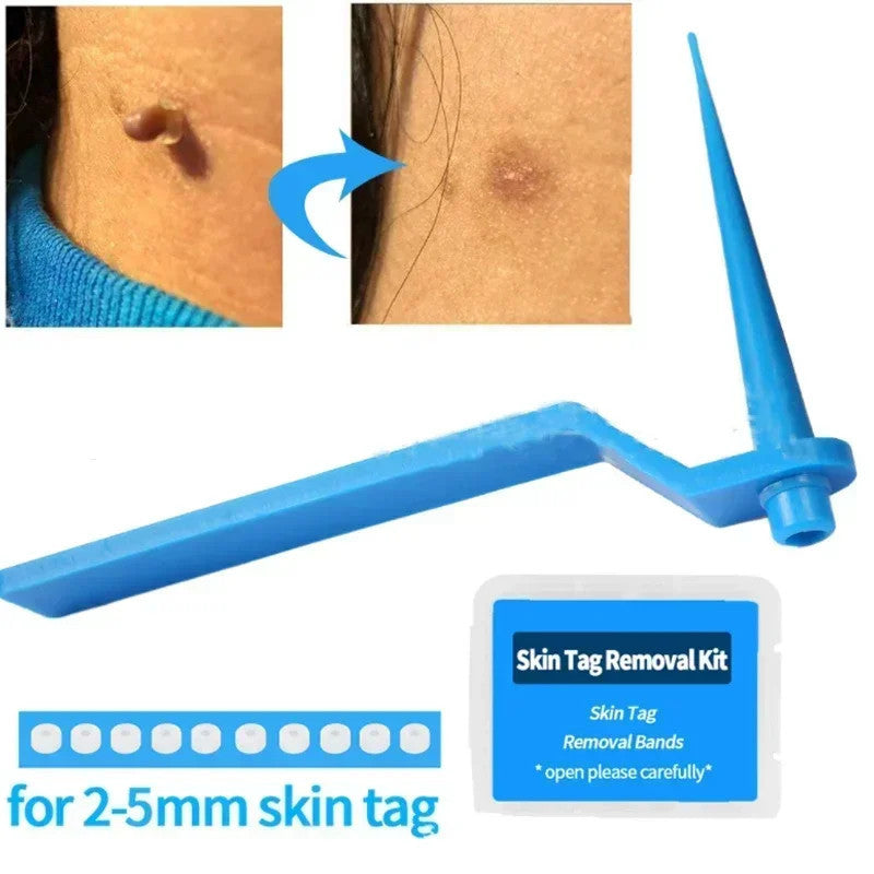 1 Set Skin Tag Removal Kit