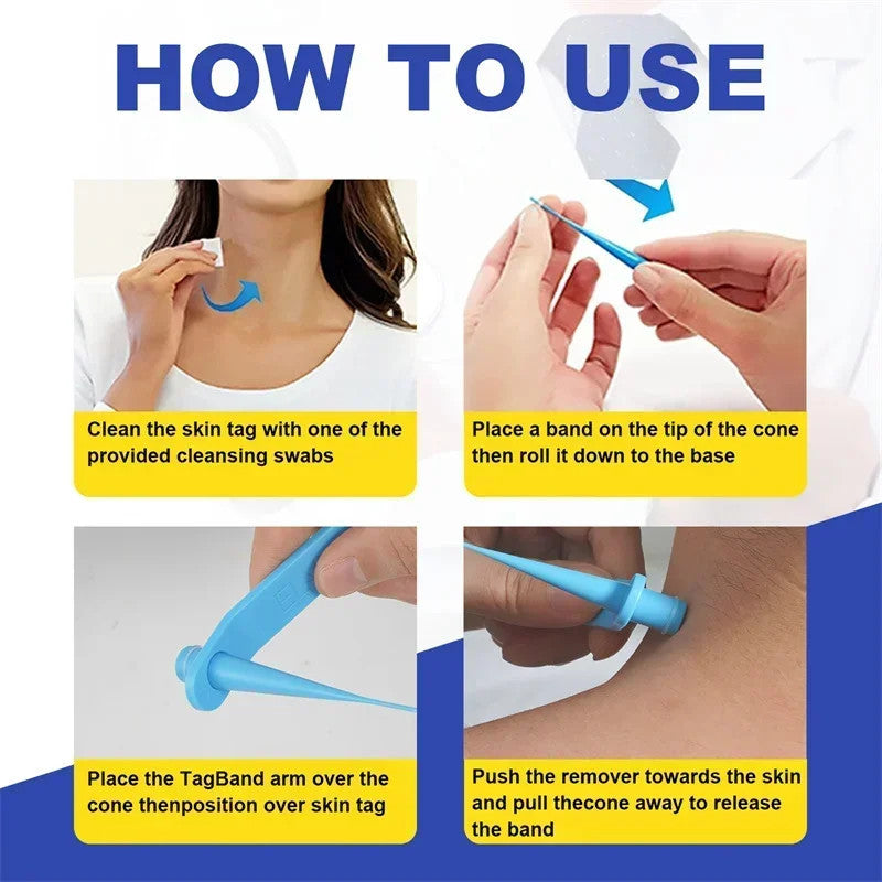 1 Set Skin Tag Removal Kit