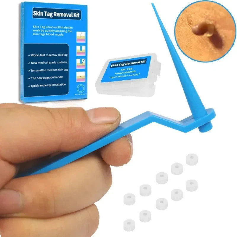 1 Set Skin Tag Removal Kit