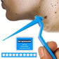 1 Set Skin Tag Removal Kit