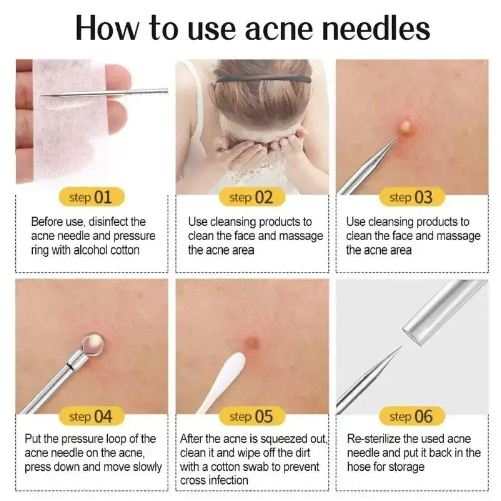 11Pcs Acne Needle Blackhead Clip Remover