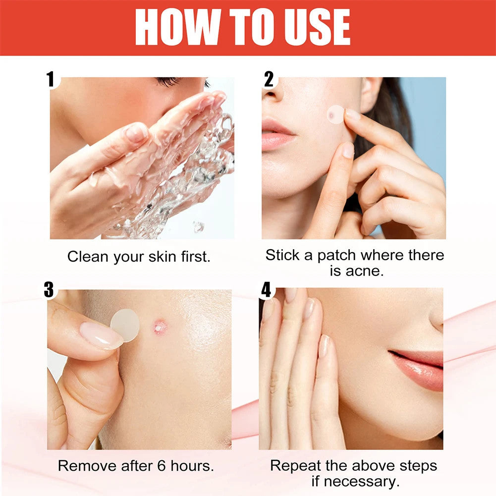144pcs/set Hydrocolloid Acne Patch