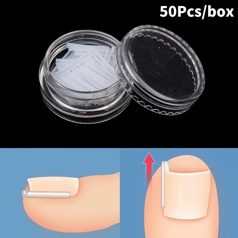 50Pcs Ingrown Toenail Correction Tool