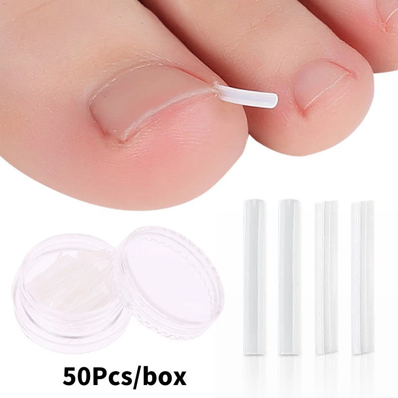 50Pcs Ingrown Toenail Correction Tool