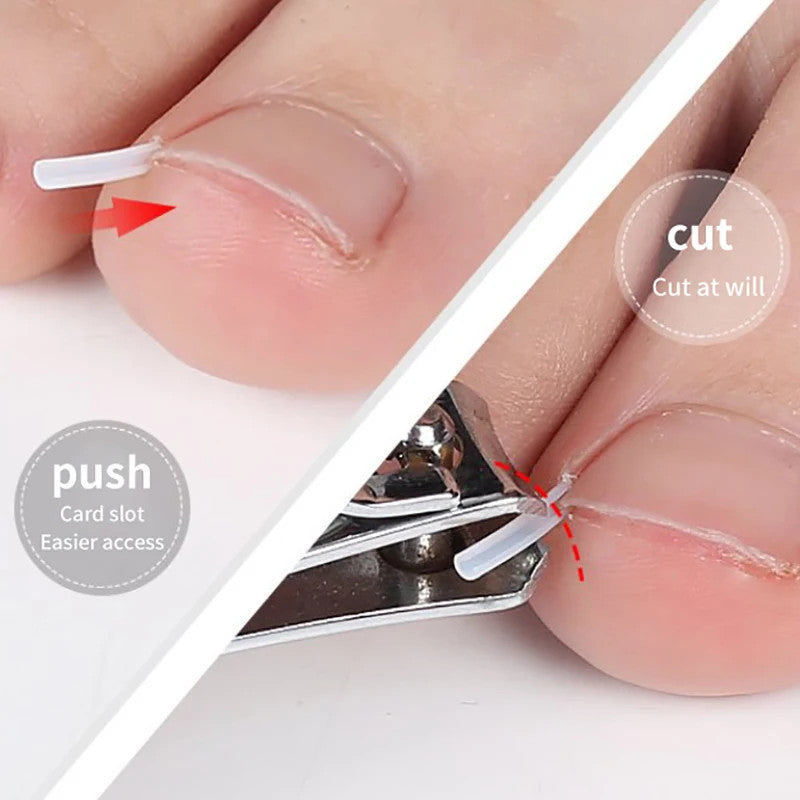 50Pcs Ingrown Toenail Correction Tool