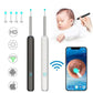 Otoscope Wifi Visible Earwax