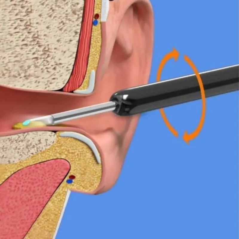 Otoscope Wifi Visible Earwax