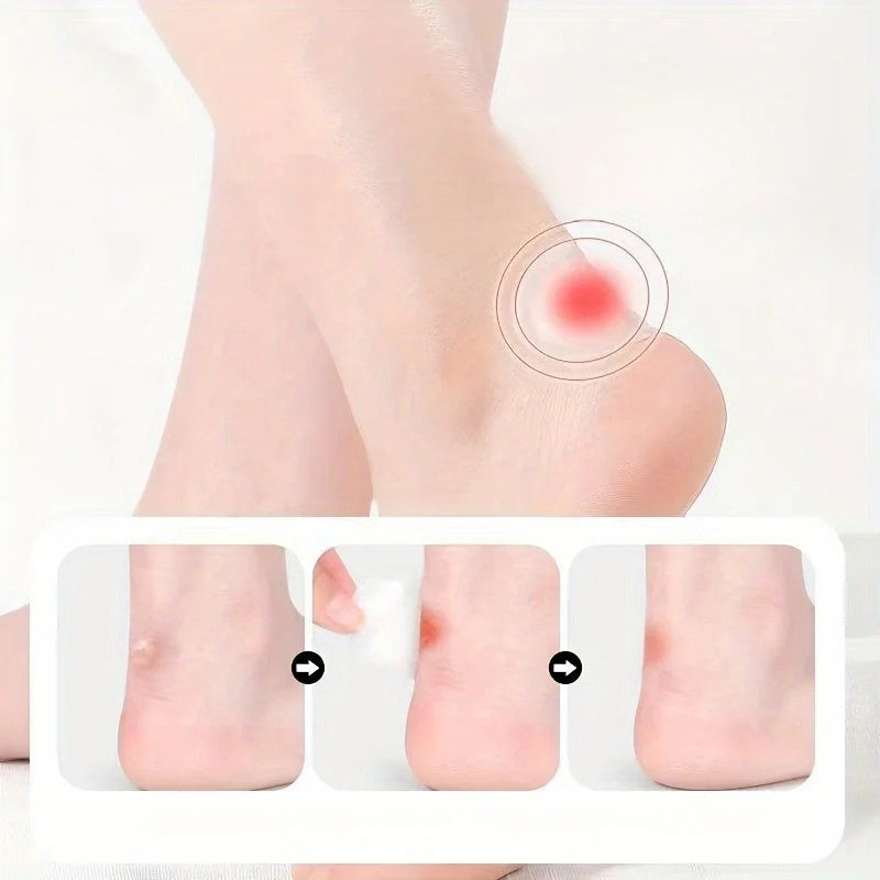15 Pcs Gel Heel & Toe Stickers