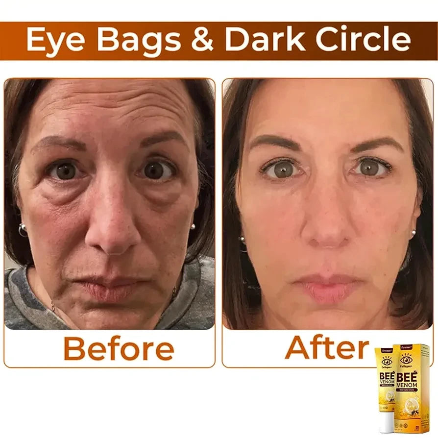 Bee eye cream