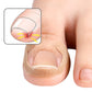 Toenail Correction Strips