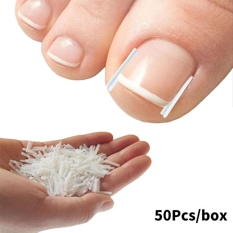 50Pcs Ingrown Toenail Correction Tool