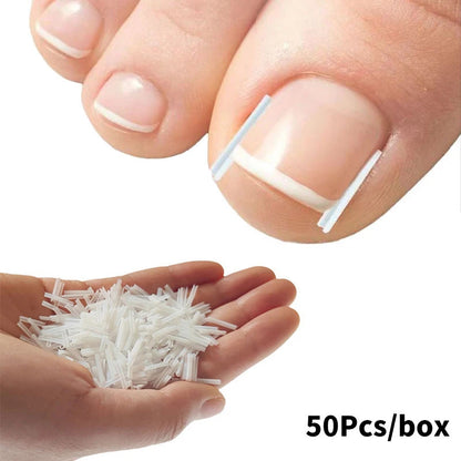 50Pcs Ingrown Toenail Correction Tool