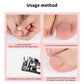 50Pcs Ingrown Toenail Correction Tool