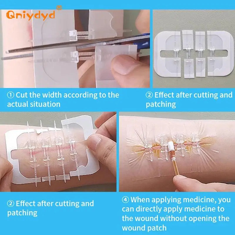 2Pcs Zipper Tie Wound Closure Patch
