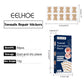 Ingrown Nail Correction Sticker 50pc