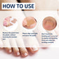 Ingrown Nail Correction Sticker 50pc