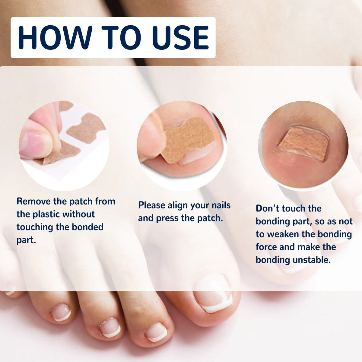 Ingrown Nail Correction Sticker 50pc