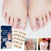 Ingrown Nail Correction Sticker 50pc