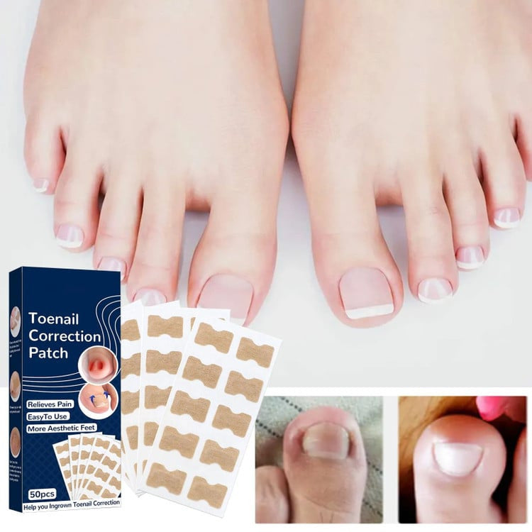 Ingrown Nail Correction Sticker 50pc