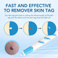 3 In1 Painless Auto Skin Tag Mole Wart Removal Kit