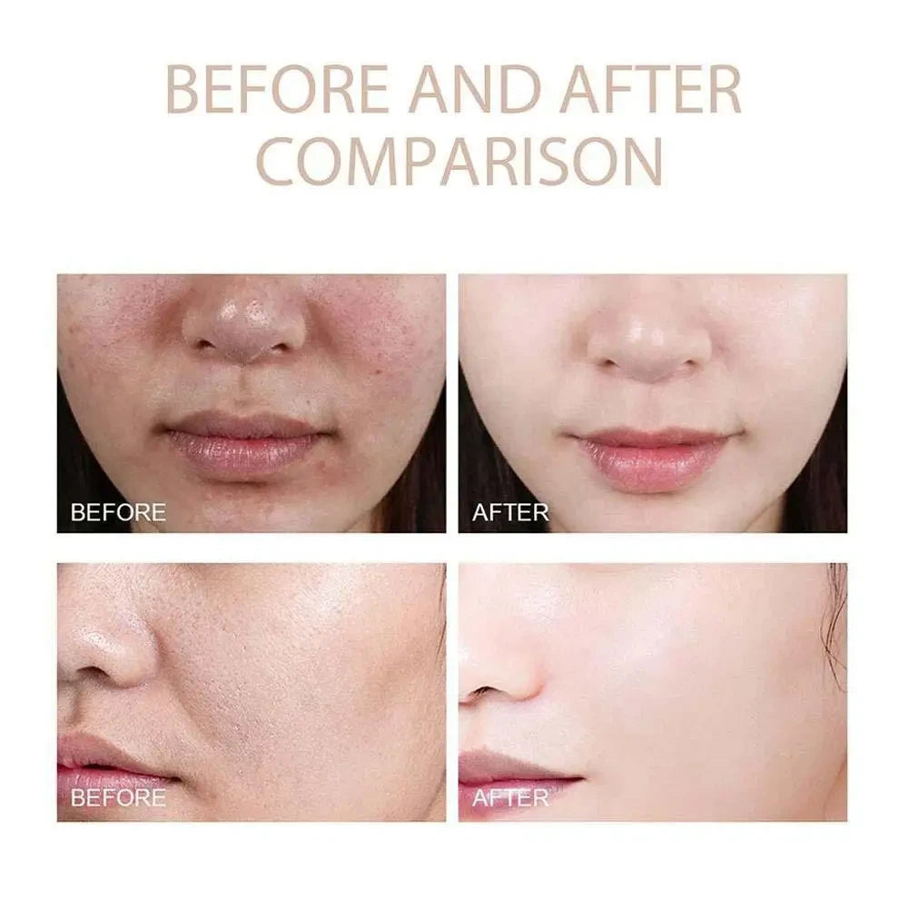 Peel Shot Glow Set