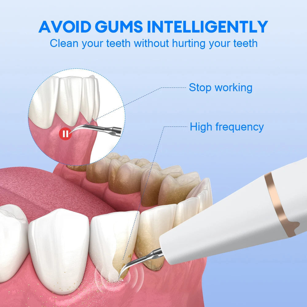 Electric Teeth Cleaner & Stain Remover