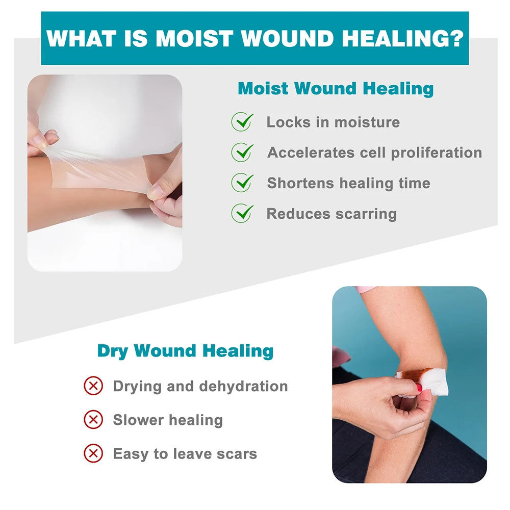 Self-Adhesive Hydrocolloid Roll