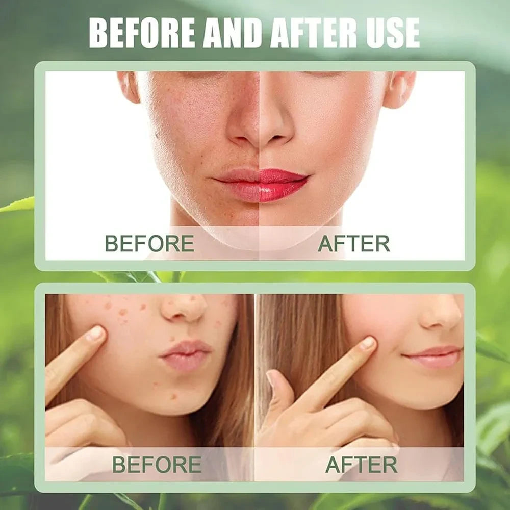 green tea mask