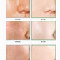 green tea mask