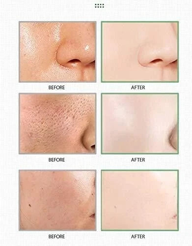 green tea mask