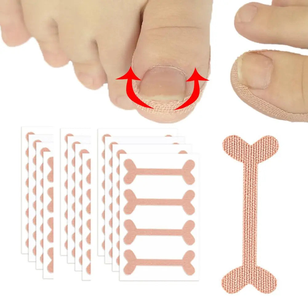 Nail Correction Stickers Ingrown Toenail Corrector Patches