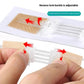 1Pc Zipper Tie Wound Closure Patch