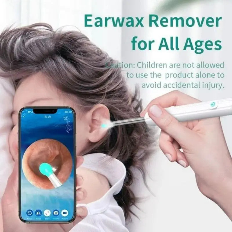 otoscope wifi visible earwax