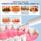 Electric Ultrasonic Dental Scaler Stain Removal