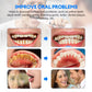 Electric Ultrasonic Dental Scaler Stain Removal