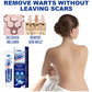 Wart Remover Cream – Fast & Effective