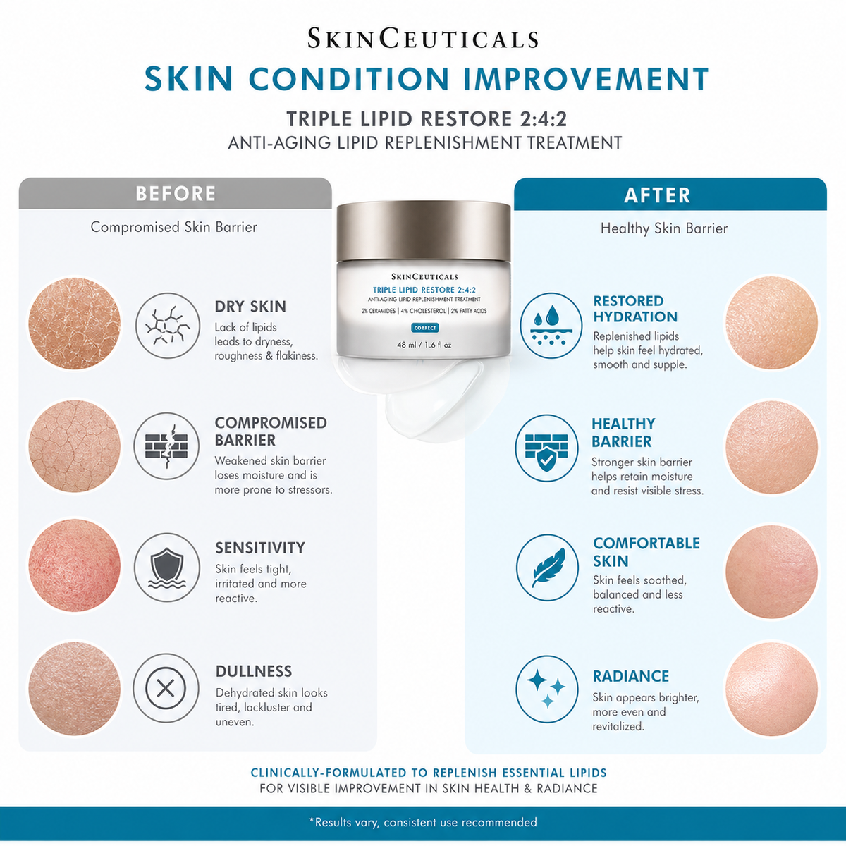 SkinCeuticals Triple Lipid Restore 2:4:2 (48ml) | Barrier Repair Cream